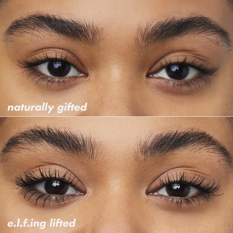 Brow Lift - Image 3