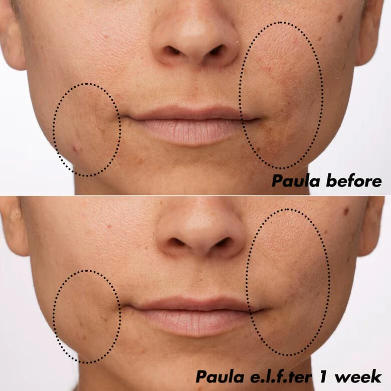 Plz Clarify Facial Oil - Image 3