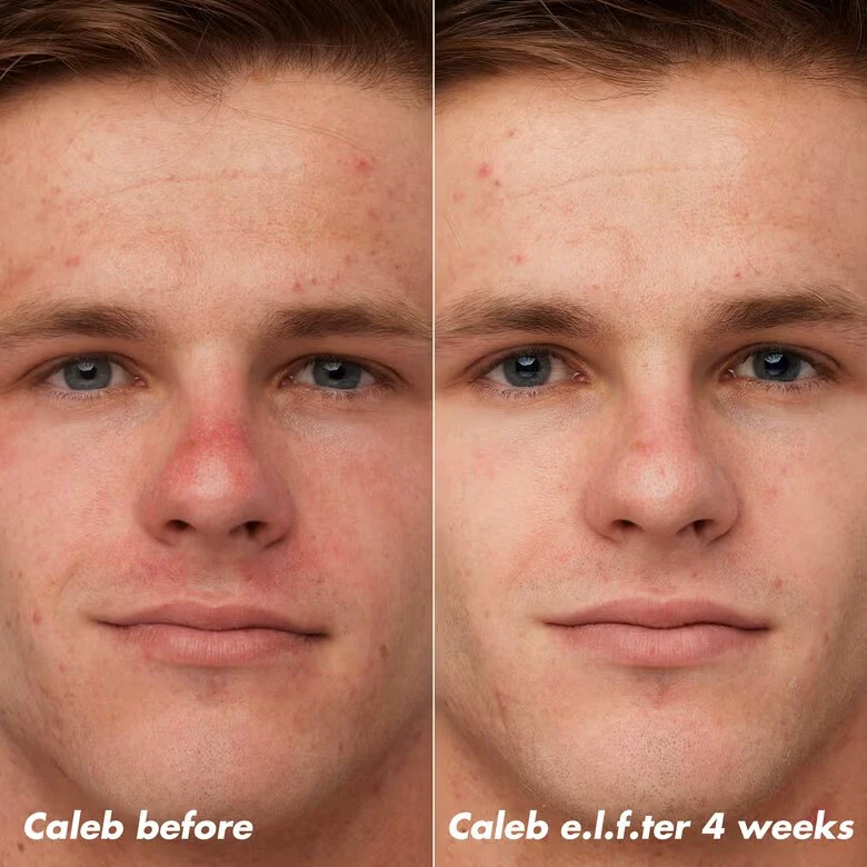 Plz Clarify Facial Oil - Image 4